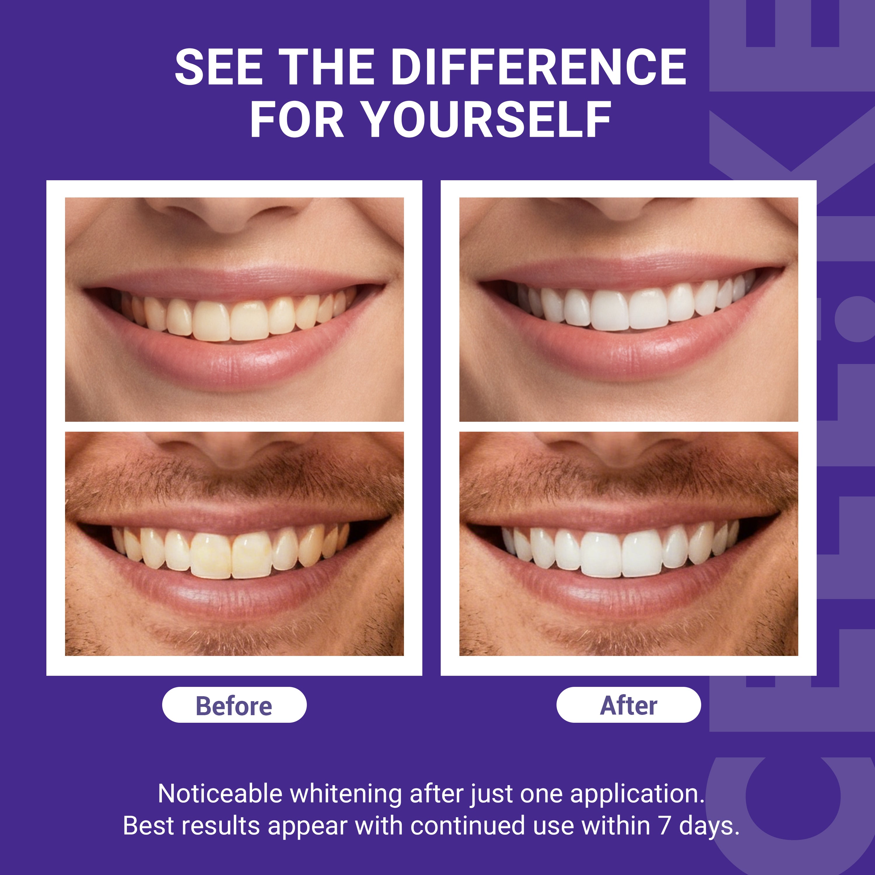 CEELIKE nHAP-Pro Whitening Strips