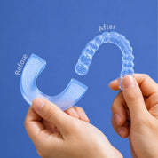 CEELIKE Custom-Fit Night Guard for Teeth Grinding