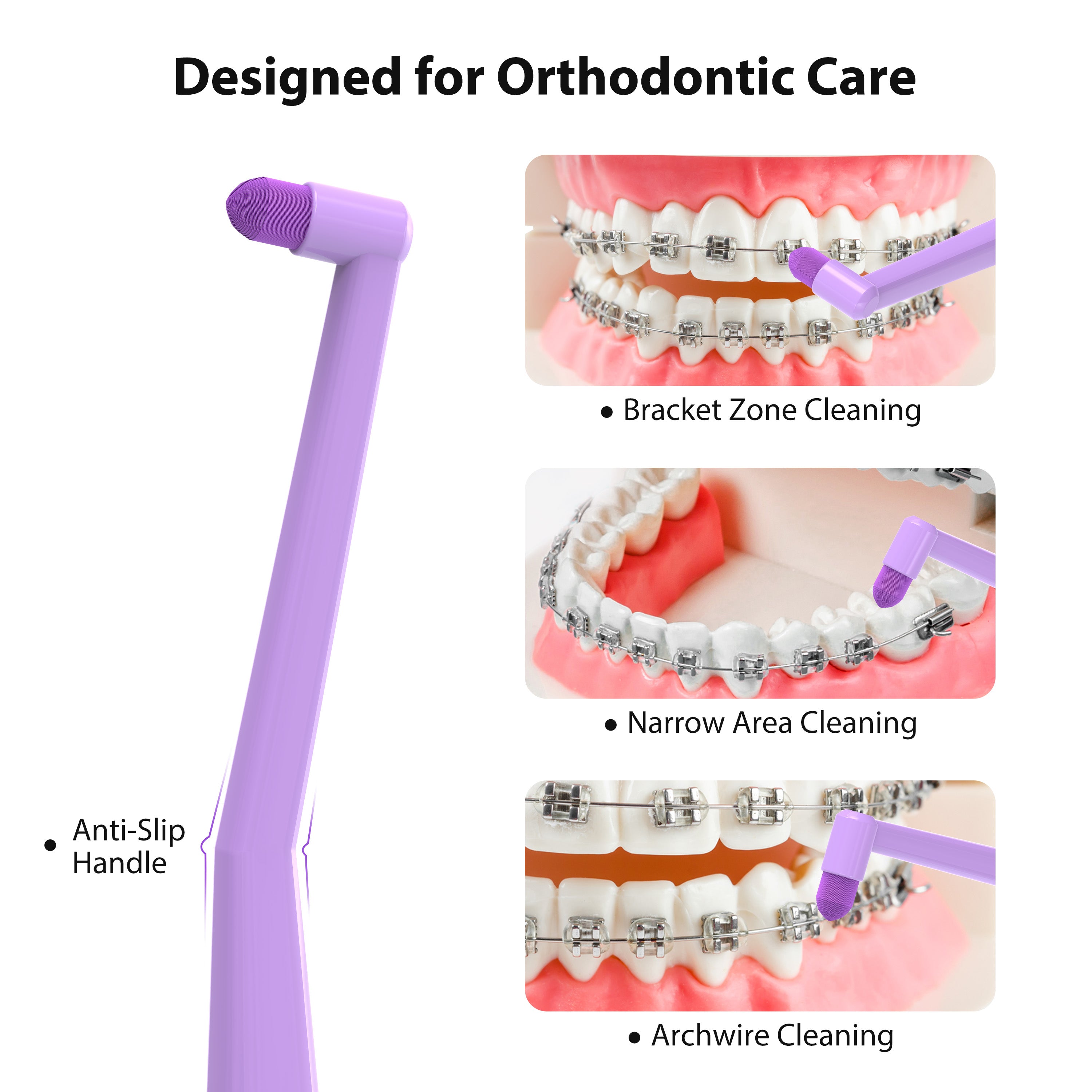CEELIKE 0.12mm Sensitive Care Orthodontic Toothbrush