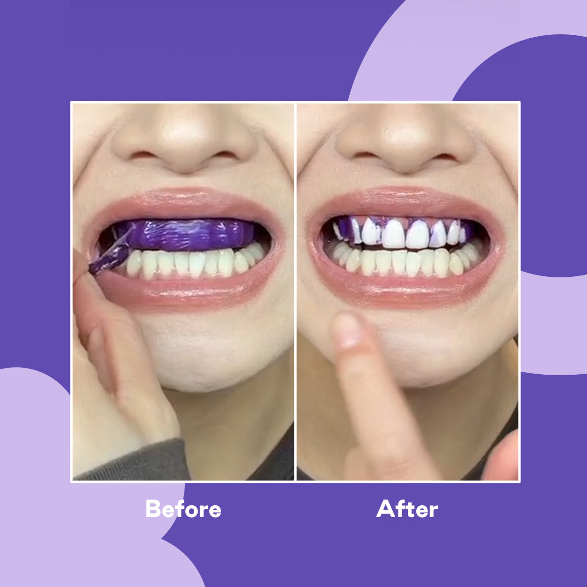 Apply the whitening strips to your teeth and leave on for 30 minutes.